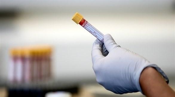 Development of a new blood test that detects people with corona without symptoms