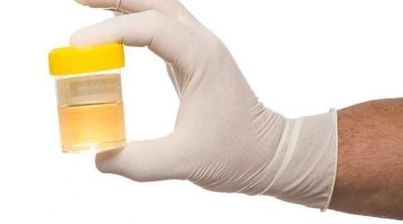 Develop a handheld device to easily detect urinary infections