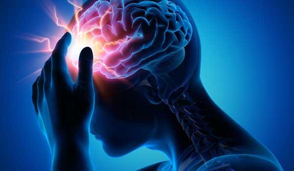 What are the causes of brain stroke?